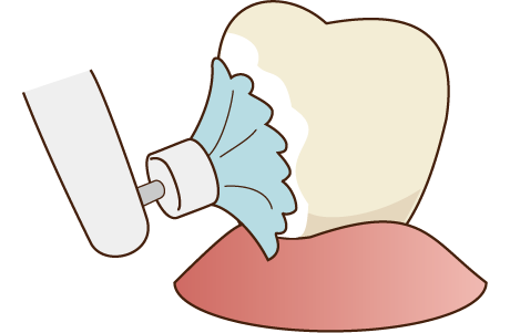 ステインを取り除く