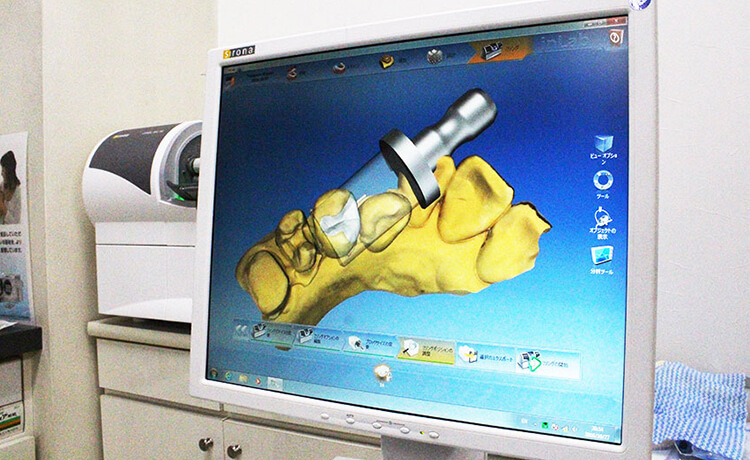 患部に修復物を接着