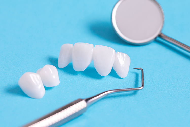 セラミック治療