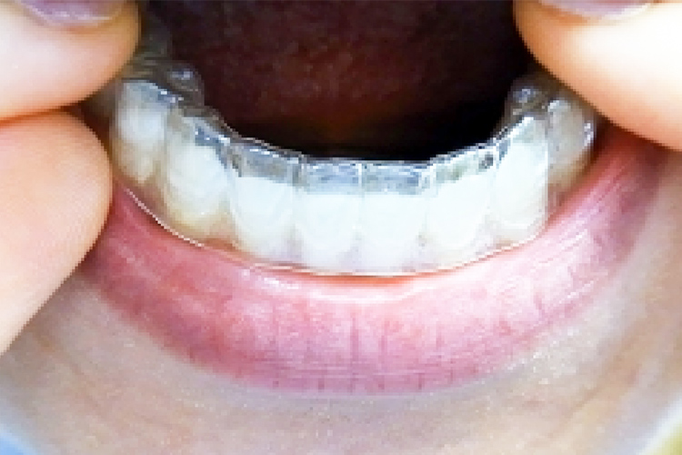 アソアライナー